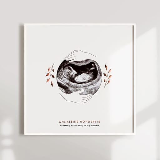Custom Sonogram Frame